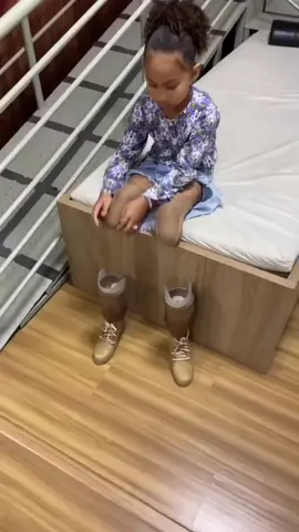 Prosthetic Legs...So touching 😰...Follow us for more innovative baby products and services #prosthetic #prostheticle #prostheticleg #prostheticlegs  #prostheticlegsrock #prostheses  #viralvideo #viralvideos #viralreels #viralreel #fy #fyp #foryoupage 