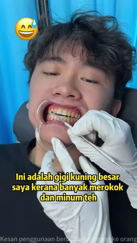 Kenapa saya tidak temui ubat gigi yang bagus seperti ini lebih awal! Jika tidak, saya tidak akan mempunyai gigi kuning dan nafas berbau untuk sekian lama. #Pemutihangigi #Nafassegar#oralshark#TikTokShopCrossBorder_SEASales