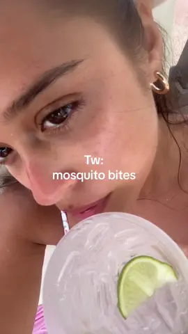 Please #fyp #mosquitobites #bugoftiktok #mexico #viamexico🇲🇽 