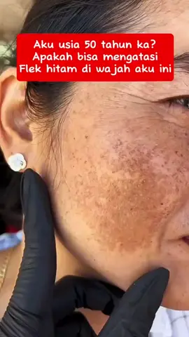 #bersamatiktok #cosmeticanatural #maskerwajah #masker #serumgakharusmahal 