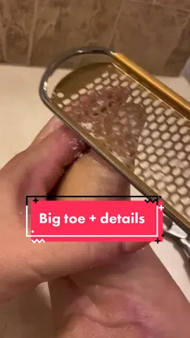 Replying to @Theresa toe maintenance part 3 #parmeseanpalms #callousremoval #skinpeeling #dermatillomania #footcallusremoval #callousedfoot #footcallus 