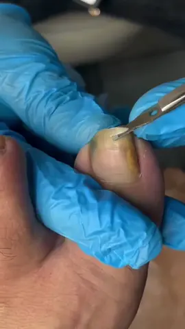 Manicure Set 32 in 1 Alat perawatan kuku 1 Set isi 32pcs Set Manikur Perawatan Kuku gunting nail tangan #guntingkuku #setmanicurepedicure #alatperawatankuku #manicureset #perawatankukutangankaki #alatmanicuresetguntingkuku 