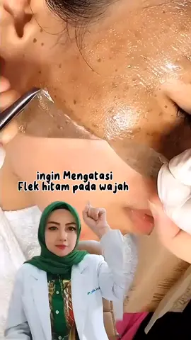 Peeling of masker bisa membatu menghilangkan flek hitam, mengangkat sel kulit mati, komedo , bekas jerawat dll. #flekhitam #flek #adera #glowing #cantik 