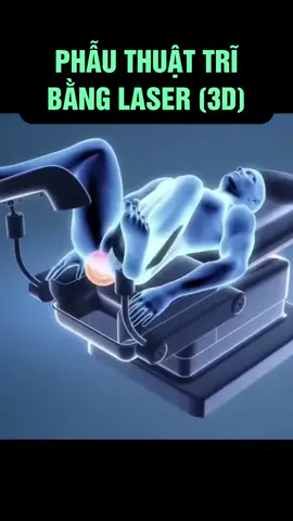 Phẫu thuật trĩ bằng laser #benhtri 