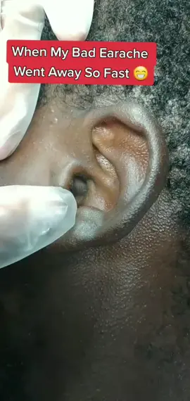 Have you tried this F0R EAR PA1N #earache #fyp #eliyahmashiach #learnfromeliyahmashiach 