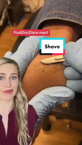 Shaving down a painful crack in the skin!  #callus #calluses #callusshaving #footcallus #podiatrist #podiatry #pedicure #foothealth #footfacts #oddlysatisfying #nailclipping 
