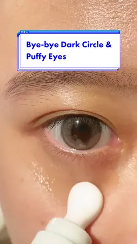 Skincare anti mata panda & garis halus🐼✨ #somethinc #eyegel #antiaging #darkcircles 