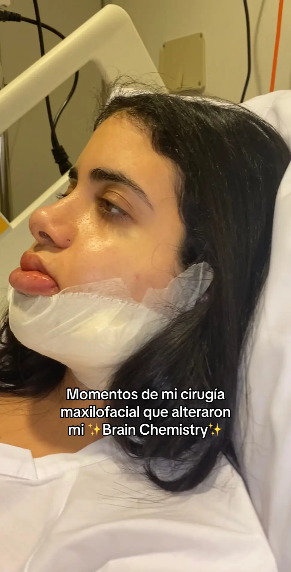 Momentos de mi Cirugía Maxilofacial que alteraron mi ✨Brain Chemistry✨El doctor que me operó: Carlos Abugattas👏🏻 #cirugiaortognatica #jawsurgery #brainchemistry #recovery #limaperu 