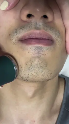 Finally no more beard poking my face 🙄 #shaving #menshaving #electricshaver #asmr 