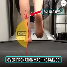 Aching Calves  has been linked to faulty foot mechanics.  In the podiatry clinic, we often use gait analysis as a tool to check for abnormal motions in the feet and then use orthotic insoles to limit the effects of these motions  #ergonx #docpods #pronation #backofheelpain #footpain #podiatrist #orthoticinsoles #orthoitcs #calfpain #achingcalves