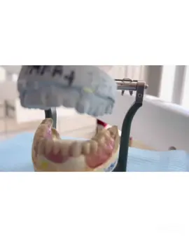 Si uite asa ne ocupam de fiecare pacient in parte🤓 #fyp #viatadestomatolog #dentalprosthetics #dentist #odontologia #caries #endodontics #trending 