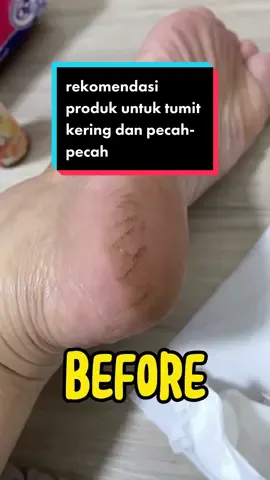 hasilnya beneran instan #tumit #tumitku #tumitkuobatkaki #tumitkuviral #kapalan #vaselinultramoisturizingcream #vaselineid #vaselinmoisturezingfoot #kakipecahpecahhilang 
