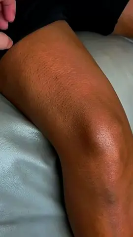 Do u want one?#foryou #skincare #beauty 