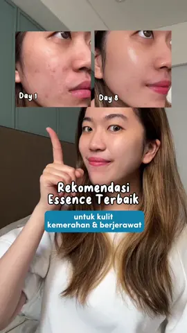 ESSENCE TERBAIK SIH INI ! 😍#YOUSkincare #FondasiHidrasi #reviewskincare #skincareviral #viraltiktok #fypシ 