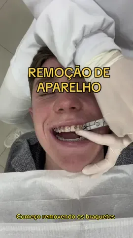 Remoção de aparelho ortodôntico! 😍 #aparelhoortodontico #dentista #dentistaentiktok #contencaoaparelho 