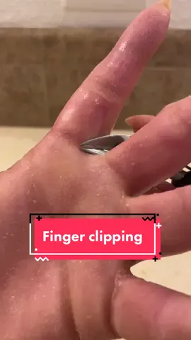 It really is a unique experience 😅 #parmeseanpalms #dermatillomania #skinpicking #skinpickingaddict #skinpeeling #podologia #dermatologia #podiatry #dermatology #callousremoval #callous #satisfyingvideo 
