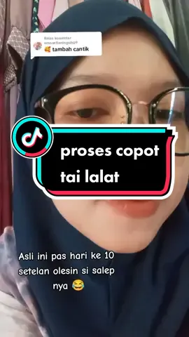 Membalas @ernasetianingsih09 wkwk rekomend buat tai lalat dan kutil mak 😂 #penghilangtahilalat #penghilangkutil #swissparislotionoriginal #fyp 