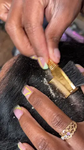 Before getting a sewin PLEASE allow your stylist to give you a deluxe shampoo and scalp treatment especially if you have issues with dandruff and dry scalp. This is a seemless sewin using 3 bundles of raw Cambodian hair. #atlanta #fyp #dandruff #dandruffremovel #sewin #atlsewins 