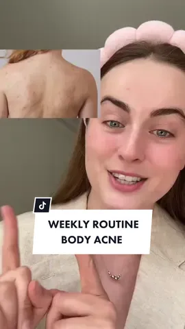 Trying is winning 🙏🏼 You need to listen to your skin and maybe a benzoyl peroxide needed instead! #salicylicacid #bodyacne #benzoylperoxide 