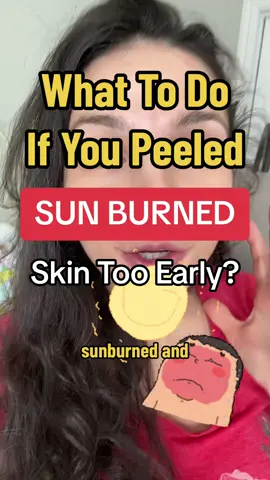 Replying to @Ean under the peeled skin, is the delicate tender red skin, which is inflammation part of the healing process as well.  if you have other skin care questions, drop them in the comments below 👇 ##victoriatabak##spf##sunprotection##skincareforbeginners##answeringquestions##skincare#skincareroutine##learnskincare##makeup##antiaging##skintok##skin##whatilearned##mom##fashion##fyp##sunburnt##sunburned