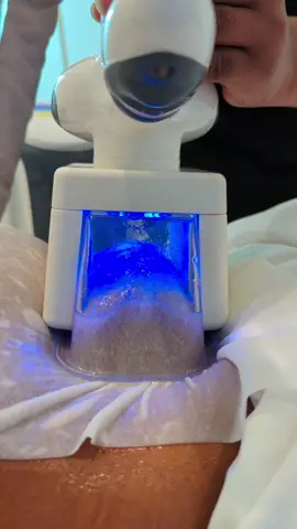 Through a process known as cryolipolysis, cool sculpting is a fat-freezing technique that aims to eliminate stubborn fat in specific areas of your body. It is a quick, easy and non-intrusive process. This procedure offers a number of advantages, such as: > A 20–25% decrease in fat cells. > The procedure only requires 40 to 60 minutes to complete. > The first 3 weeks will show some results, although it may take up to 2 months to see the full effects. #liposuction  #tiktok  #bodybydesignkenya  #fatloss 