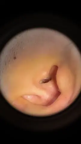 Guess how long he hasn’t cleaned his ears#earwax #earwaxremoval #satisfying #foryou #fyp#earcleaning #earcleaningtool #earwaxremoval #earcamera 