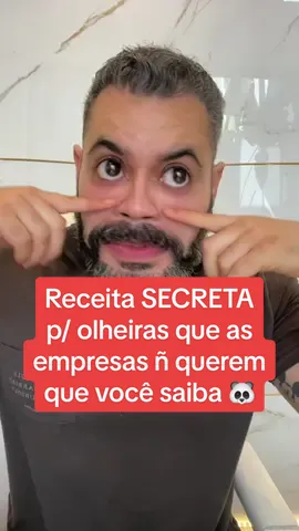 #festivaldecomedia #olheiras #olheirasescuras #olheirasprofundas #clareadordemanchas #clarearolheiras #clareamentocaseiro 