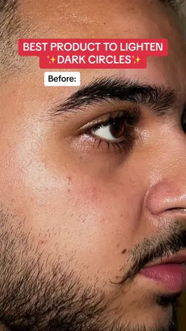 Best product to lighten dark circles, uneven skin & pigmentation💛 #foryoupage #foryou #trending #acne #acneskin #skin #skincare #clearskin #hyperpigmentationtreatment #desi 