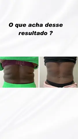 #esteticalisboa #esteticaportugal #foryou 