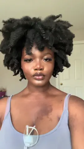 💋💋💋 #blackgirl #miniinfluencer #makeup #makeuptutorial #MakeupRoutine #pretty #teen #blackgirltiktok #blackgirlmagic #blackwomeninluxury #darkskin #darkskinmakeup #ukgirlmakeup #affordablemakeup #deugstoremakeup #sunscreen #hotgirlsummer #repost #contentcreator #followme #fyp #fyp #foryou #foryoupage #4u #taylorswift #cute #nosepiercing #naturalhair #summerhairstyles #boxbraids #DIY #tutorial #tiktok #tiktokindia #tiktoker #minibrands #blackwomenoftiktok #teenager #beauty #beautyhacks #beautytips #BeautyTok #fitme #maybelline #elf #cosmetics #nyx #fentybeauty #affordablefinds #drugstoremakeup #woc #wocmakeup #dmv #cameroon #kamer #westafrican #westafricanfood #africanwomen #lightskin #brownskin #Summer #2023 #fullface #threads #speaknow #bikini #bikinimodel #cubantwist #passiontwists #teenmodel #teeninfluencer #youtube #digitalcreator #CapCut #icespice #munch #munchkins #barbie #makeupartist #mua #makeuptips #makeuphacks #makeupchallenge #concealer #foundation #contour #blush #concealer #foundation #contour #blush #settingpowder #longlastingmakeup #pressingpower #settingspray #lipcombo #akwitanwi #bamenda #bamendagirl DI #cameroonian #cameroontiktok #rema #burnaboy #237 #sponsorme #eyebrowtutorial #instagram #cute #sweet16 #bts #pinktape #blowthisup #burhan_tv #blackpink #asmr #art #challenge #DIY #fyp viral #gym #GymTok #gymmotivation #makeupremoval #h3h3 #hashtags #hashtags #faceliftmakeup 