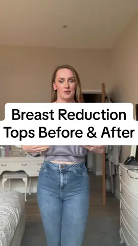 Trying on tops before and after my breast reduction surgery. I think my face says it all!  #breastreduction #breastreductionsurgery #journey #surgery #postop #happy #transformation #transformationchallenge #lifechanging 