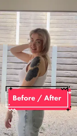 Embrace yourself, every step of the way 🫶🏼 ______________ #wls #baribabe #bariatricsurgery #vsg #gastricsleeve #extremeweightloss  #transformation  #vsglife #postopvsg   #thenvsnow  #beforeandafterwls #vsgglowup 