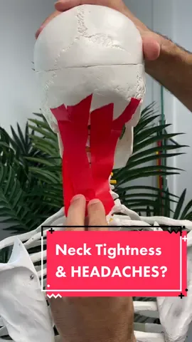 Do you experience persistent headaches and you also feel tension in the back of the neck and base of the skull? Well, you may be experiencing tightness from the neck which is compressing the nerves at the base of the skull producing suboccipital neuralgia, which is compression of the greater occipital nerve. These types of headaches can be persistent in the back of the head or the side of the head all the way to the eye. This is a great way to release those muscles and free up the space in the base of the skull to reduce headaches. #tensionheadache #headacherelief #migrainelife #cervicogenicheadache #tmjtreatment #tmjdisorder 