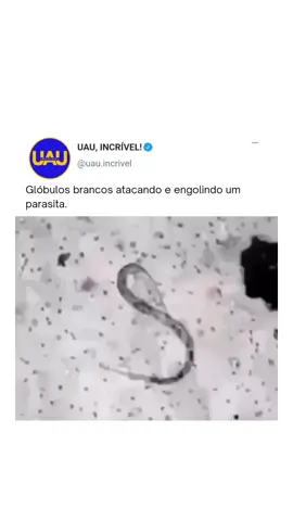 Os glóbulos brancos são células do sistema imunológico que atacam e destroem parasitas e outros invasores do corpo. Esse processo é essencial para nos proteger de infecções e doenças. Os glóbulos brancos envolvem e englobam o parasita, destruindo-o por meio de fagocitose, uma ação vital para nossa saúde. #curiosidades #ciencia #anatomia #interessante 