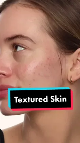 Textured skin layering technique #texturedskin #acne #foundation #makeup 