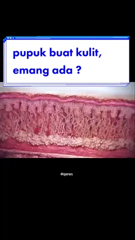collagen stinulator boleh dilakukan 1-2x dalam setahun, ada banyak jenisnya misal CaHA, PCL, PLA, PLLA dll.. nah semua ada plus minusnya sendiri²  #collagenstimulator #elastin #kolagen #dokterorlen #qeren 