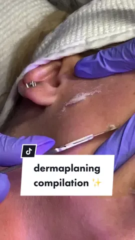 Replying to @joannakusznerko11 can’t find the comment that asked for a dermaplaning compilation video so here it is 🤍 #asmrsounds #asmr #asmrskincare #asmrpov #dallasmedspa 