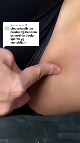 Membalas @🌷 Jangan sampe Slengk0n9mu gelap ya 🤮 #tonerbadan #tonerbadanbpom #tonerbadanviral #tonerbadanaleya #tonerbadanwhitening #tonerbadansafron #penghilangdaki #penghilangdakimembandel #penghilangdakiketiak #perontokdaki #perontokdakiviral #perontokdakimurah #perontokdakiampuh #fyp #fypシ #aleyaskincare 