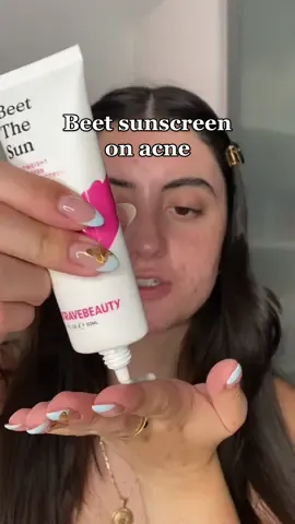 SPF IS YOUR BFF 👏🏻👏🏻 what do you think of this new sunscreen from @KraveBeauty shop beet the sun with the link in my bio 🥰#skincare #sunscreenreview #acneskincare #acnepositivity #beautytips #kbpartner #beetthesun 