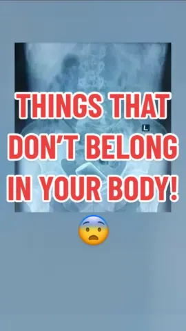 Watch until the end. Trust me 😂#thingsthatdontbelonginyourbody #foriegnbodyremoval #foriegnbody #madmedicine #tiktokdoctor #doctor #physician #dare#greenscreen 