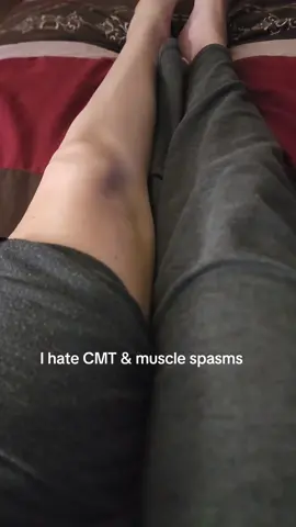 Uncontrollable muscle spasms in my knee started 2 hours ago. I didn't realize you could see it so clearly till I actually stared at it. #charcotmarietooth 