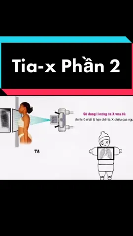 #nhathuoclongchau356 #duocsibaochau #viralvideo #moinguoi #kienthuc #suckhoe #xquang #tiax 