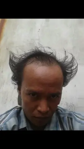 3 Ide Pose Foto Keren Yg Gokil Pokoknya Bodo Amat  #OOTD #fyp #fypシ #fypシ゚viral #bodoamat