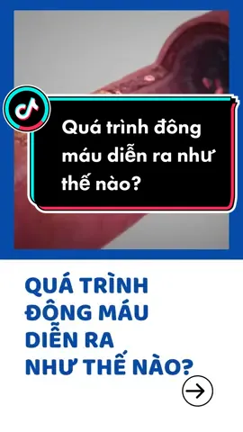 Quá trình đông máu diễn ra như thế nào? #medlatec #thongtin #suckhoe 