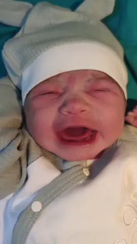 #jinekologdrmuratkayaoglu #jinekologmuratkayaoglu #newbornvsnowchallenge #newbornstage #newbornglow #newbornshoot😍 #newbornsafety #newbornscrunch #bebekvideolar #bebekler #normaldoğum #yenidogan #yenidoğan #newbornsession #küçükbebek #küçükmucize #hamileyimanneyim #hamilelikhaberi #hamilelikserüveni 