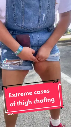 Save your thighs! The Chub Rub patch is a great solution and preventative 💗 #th#thickthighessaveslivesh#chafingh#chubrubh#chubrubproblemsolvedh#thighsh#chubi#tiktokshop