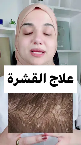 علاج القشرة#قشرة_الشعر #قشرة_الرأس #قشره_الشعر #القشرة #القشره #القشرة_في_الشعر 