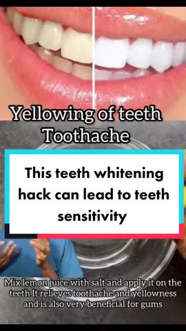 There are safer ways to whiten your teeth, don’t try this at home. #whiteteeth #dontdothis #teethwhitening #teethwhiteninghack #teethsensitivity #sensitiveteeth #yellowteeth #teethbits #portharcourtdentist #dentistinportharcourt #drnenye #doctornenye #dentistreacts #greenscreenvideo 