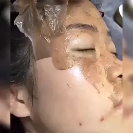 Cek Bio Untuk Pemesanan #tiktok #fyp #darkspot #flekhitamhilang #flekmembandel #flekhitam #aman 