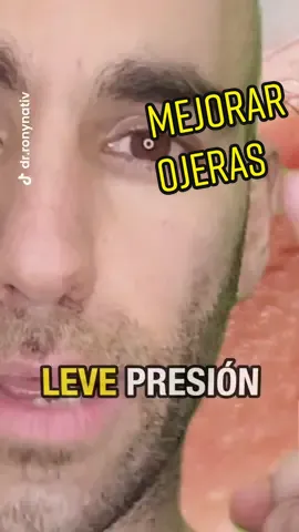 Cómo mejorar las ojeras muy marcadas. Tipos de ojeras. Tratamiento para las ojeras. Cómo disimular las ojeras. Qué hacer con las ojeras. Qué son las ojeras. Por qué tengo ojeras. Tipa para ojeras. #ojeras #ojerapigmentada #manchas #niacinamida #retenciondeliquidos #dermatologo 